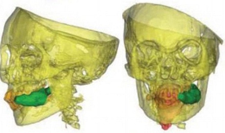 Phát hiện bí mật trong xác ướp Inca 500 tuổi
