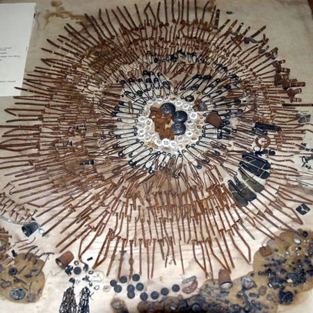 Hơn 1000 dị vật được lấy ra từ bụng bệnh nhân tâm thần.