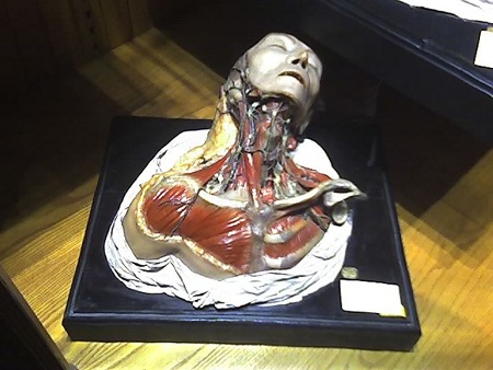 Bảo tàng Mutter nơi trưng bày những
hiện vật liên quan đến giải phẫu và bệnh học.