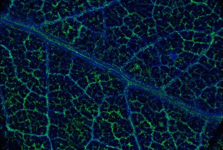 Ảnh chụp X-quang cho thấy các hạt
vàng và kim loại khác trong cấu trúc lá bạch đàn ở Úc.