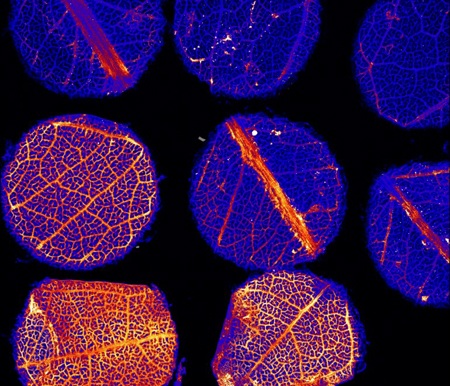 Ảnh chụp X-quang cho thấy các hạt
vàng và kim loại khác trong cấu trúc lá bạch đàn ở Úc.