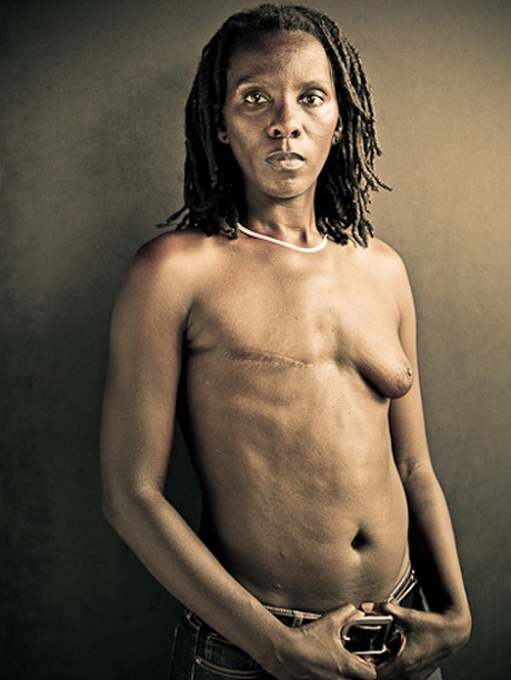 Trọn bộ ảnh về sự nghiệt ngã của căn bệnh ung thư vú - 11 Bích Ngọc