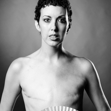 Trọn bộ ảnh về sự nghiệt ngã của căn bệnh ung thư vú - 13 Bích Ngọc