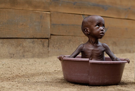 Nhìn để thấy sự khủng khiếp của đói nghèo - 4 Một em bé người Somalia trong trại tị nạn Dadaab (Kenya).
