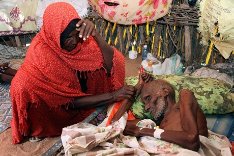 Nhìn để thấy sự khủng khiếp của đói nghèo - 7 Một em bé người Somalia trong trại tị nạn Dadaab (Kenya).