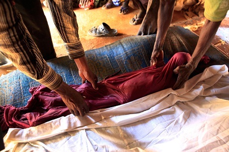 Nhìn để thấy sự khủng khiếp của đói nghèo - 8 Một em bé người Somalia trong trại tị nạn Dadaab (Kenya).