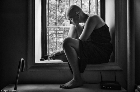 Bộ ảnh xúc động về cặp vợ chồng chiến đấu với bệnh ung thư - 3 Giai đoạn đầu khi Jennifer mới được bác sĩ chẩn đoán mắc phải căn bệnh hiểm nghèo.