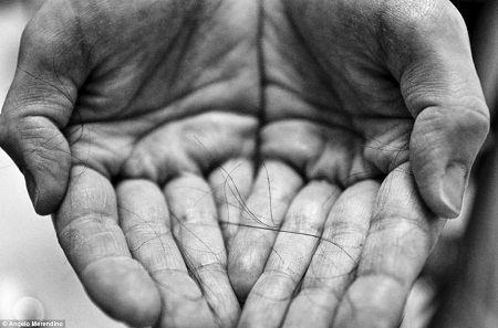 Bộ ảnh xúc động về cặp vợ chồng chiến đấu với bệnh ung thư - 9 Tình trạng của cô xấu dần đi và Jennifer đã qua đời ở tuổi 40 hồi cuối năm 2011.