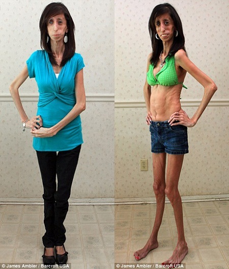 Cuốn sách về cuộc đời cô gái gầy nhất thế giới đắt khách