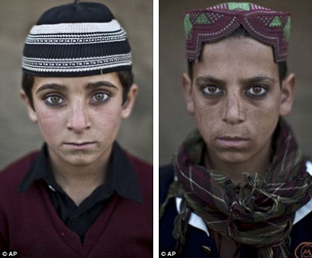 Chuyện về những em bé khốn khổ ở Afghanistan - 4 Em Hayat Khan (bên trái, 8 tuổi) và em Akhtar Babrek (bên phải, 13 tuổi).