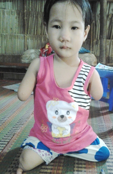 Quỹ Nhân ái hỗ trợ 5 triệu đồng đến cháu bé không tay không chân - 1 Cháu bé không tay không chân Trần Thị Hiếu Thảo rất tội nghiệp.