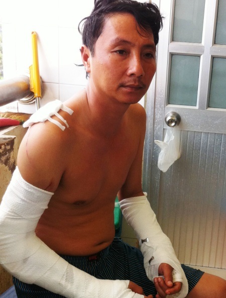 Ông Phan Văn Minh - người bị chém nặng nhất đang điều trị tại bệnh viện.