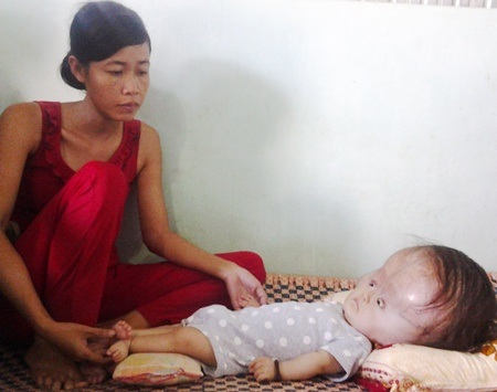 Cháu bé 15 tháng tuổi bị não úng thủy tiếp tục nhận hơn 56 triệu đồng - 1 Mẹ con chị Trần Thị Lượm nhận được nhiều sự quan tâm của bạn đọc Dân trí.