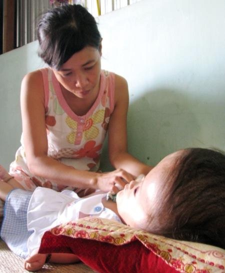 15 tháng tuổi, bé Yến mắc đến 4 căn bệnh hiểm nghèo.