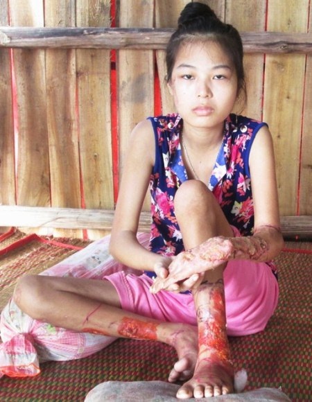 Em Trương Kiều Diễm đang mắc một căn bệnh quái ác hành hạ em suốt 2 năm qua.