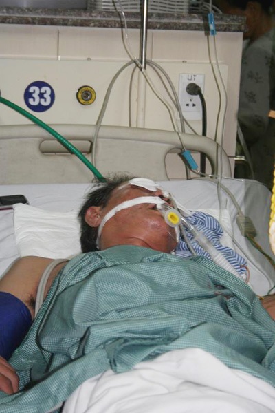 Bác sỹ đã bất lực trước ca cấp cứu của diễn viên Hồng Sơn - 5