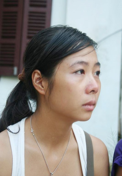 Bác sỹ đã bất lực trước ca cấp cứu của diễn viên Hồng Sơn - 1