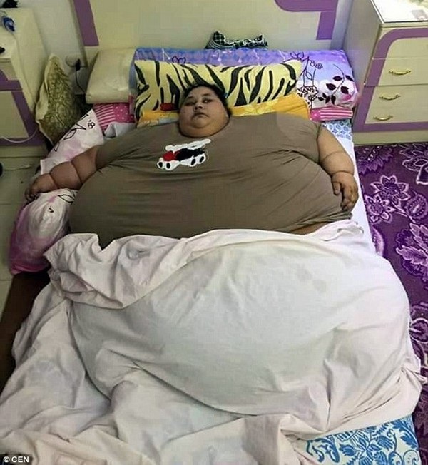 Người phụ nữ mập nhất thế giới không thể rời nhà suốt 25 năm qua - 1 Iman Ahmad Abdulati là người phụ nữ mập nhất thế giới với cân nặng lên đến 500kg
