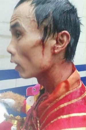 Bảy... Tôn Ngộ Không bị cảnh sát bắt vì đánh nhau tóe máu giữa đường - 2 Một trong các “Tôn Ngộ Không” bị thương ở đầu và chảy máu