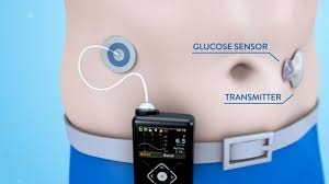 Insulin “không chích”: Thành quả của công nghệ sinh học - 5