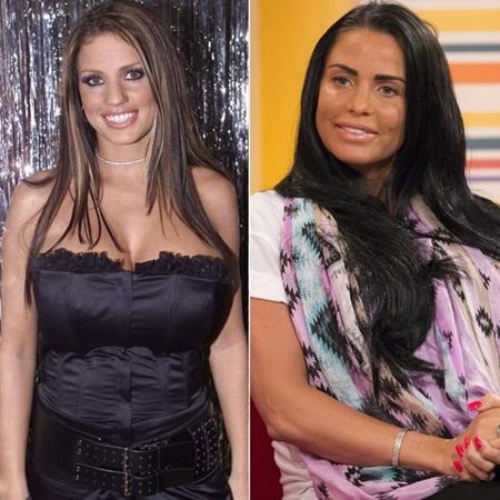 Những sao mê phẫu thuật thẩm mỹ - 5 Cô người mẫu xinh đẹp Katie Price thực sự đã “đổi ngọc lấy ngói” khi quyết định phẫu thuật thẩm mĩ. Những cuộc “trùng tu” nhan sắc chỉ khiến Katie Price ngày càng “xuống sắc” thảm hại hơn.