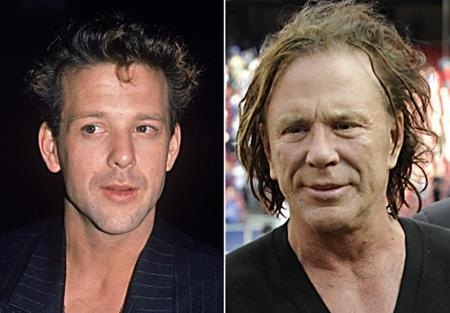 Những sao mê phẫu thuật thẩm mỹ - 10 Trước đây, Mickey Rourke được biết đến với vai trò là một cựu võ sĩ quyền anh đồng thời là một diễn viên, biên kịch nổi tiếng của nước Mỹ. Còn hiện tại, ấn tượng đầu tiên về Mickey Rourke chính là gương mặt thay đổi 180 độ do phẫu thuật thẩm mĩ.