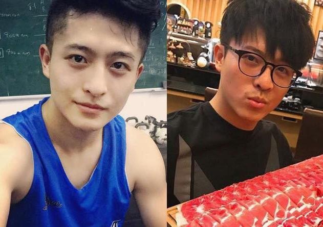 Khuôn mặt được coi là “biến sắc” sau khi phẫu thuật của Harry.