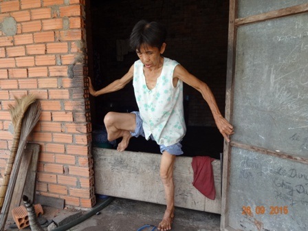 “Đau quá đi thôi, chắc tôi chết mất!” - 1