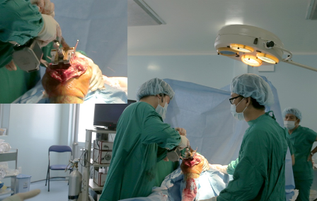 Thay khớp gối là kỹ thuật khó nhưng đã được Bệnh viện Huyện Củ Chi thực hiện thành công