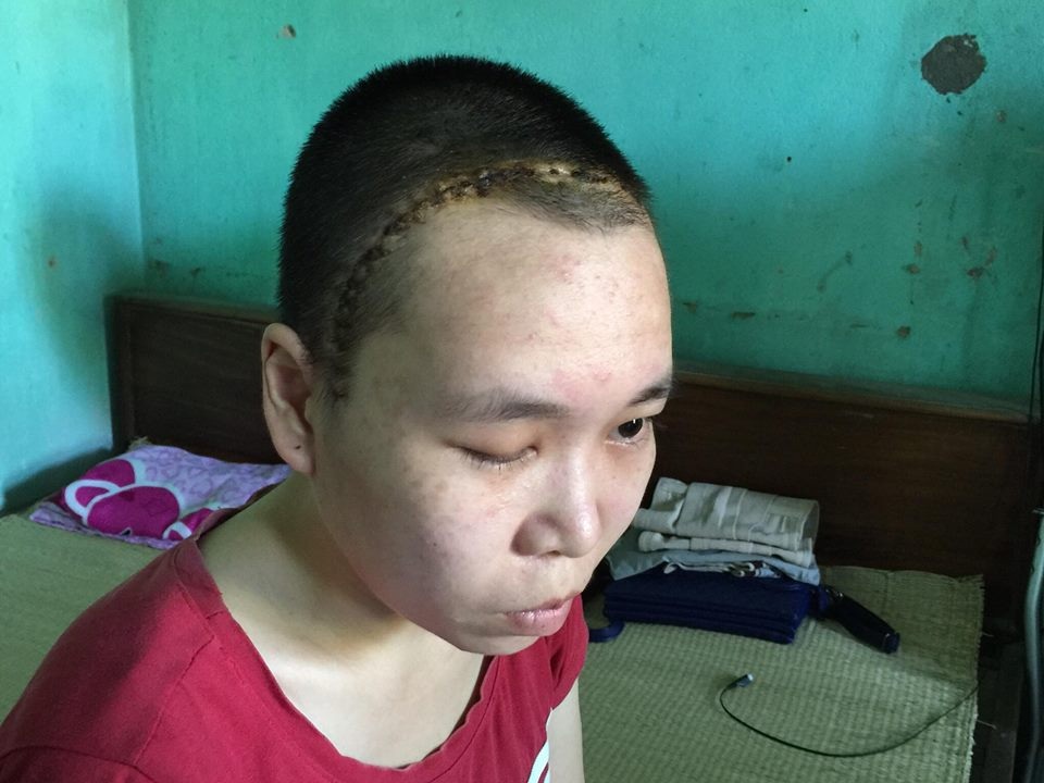 Vụ áp dụng sai văn bản, người lao động “lĩnh đủ” - 3 Trải qua nhiều cuộc phẫu thuật, tiêu tốn hàng trăm triệu đồng nhưng cô Mị không được chỉ trả bảo hiểm vì nhà trường không đóng bảo hiểm cho cô đúng quy định.