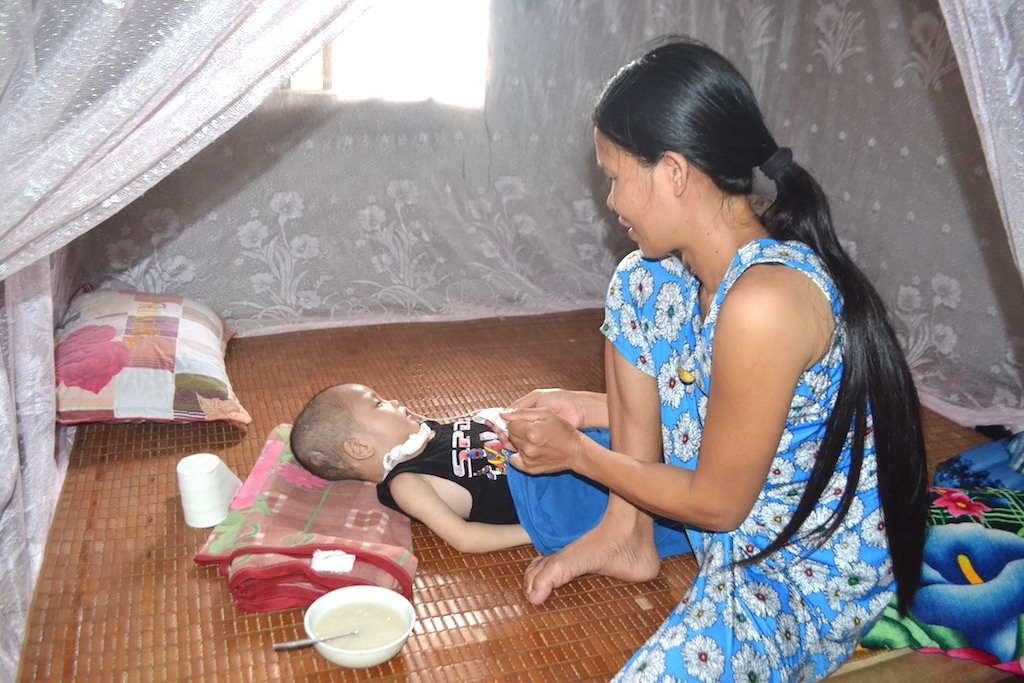 Chị Hương phải đặt ống thông mũi mới cho được con ăn.