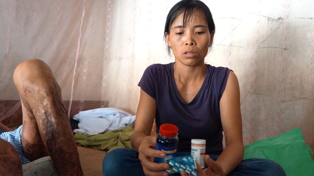 Người đàn ông bị bỏng nặng do bất ngờ ngất xỉu khi đang đốt vỏ ngô - 6 Hiện tại mỗi tháng tiền thuốc cho anh Phương cũng mất 10 triệu/tháng.