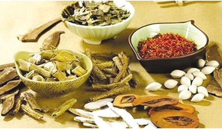 Thiếu máu não - Không nên chủ quan - 2 Huyết phủ trục ứ thang bài thuốc trị thiếu máu não hiệu quả