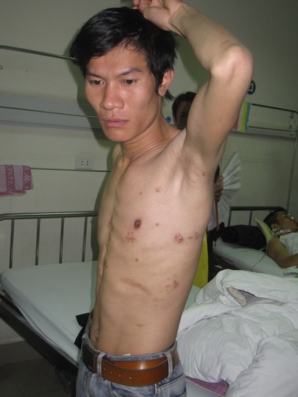 Đề nghị sớm làm rõ vụ chém người dã man tại Thường Tín - 2