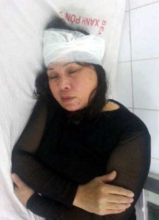 Đề nghị điều tra vụ một phụ nữ bị ném vỡ đầu giữa thủ đô - 1 Sau khi bị hành hung, nạn được người thân đưa đi cấp cứu tại Bệnh viện Xanh Pôn