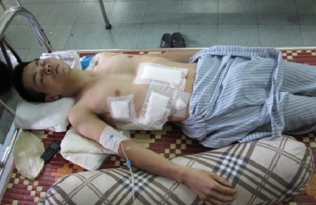 Bùi Khắc Anh đã phải vật lộn với những giây phút nguy kịch