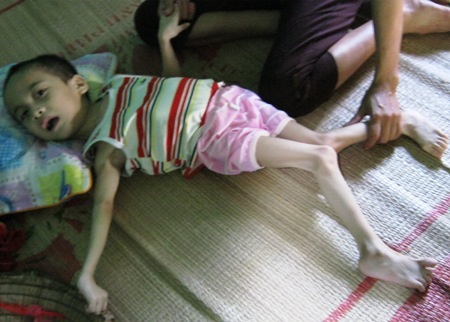 Đôi chân, tay em co quắp lại, người giật bắn mỗi khi lên cơn