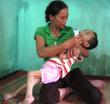 Bệnh tật khiến em phải ăn uống, sinh hoạt trong khó nhọc
