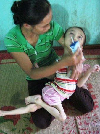 Thấy con quằn quại trong đau đớn nhưng vợ chồng anh Quỳnh cũng lực bất tòng tâm