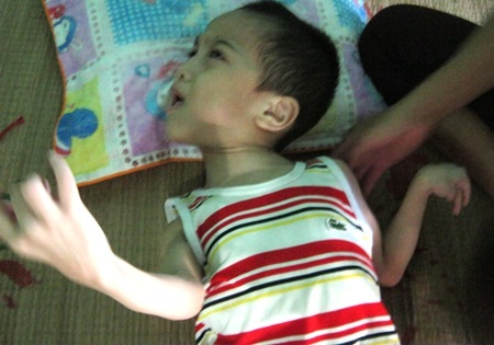 Bệnh của bé Đức cứ ngày một nặng thêm khiến anh Quỳnh, chị Mai hết sức lo lắng