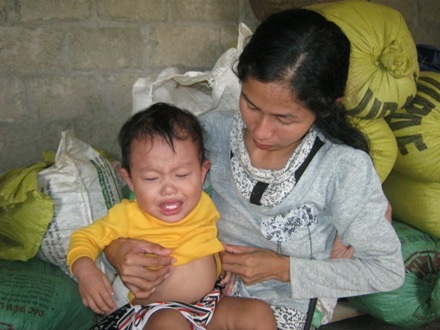 Bụng cháu Quân đang có dấu hiệu chướng lên mà không rõ nguyên nhân