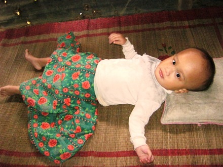 Đầu của bé Thiện đang ngày một lớn dần, sự sống đang bị đe dọa 