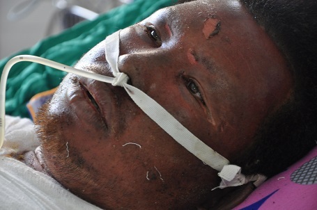 Hiện anh đang trong giai đoạn nguy kịch.