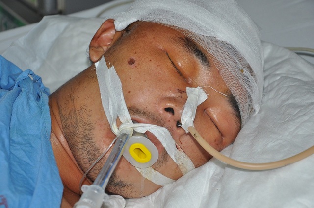 
Hiện em đã được chuyển về bệnh viện đa khoa tỉnh Hải Dương nhưng vẫn trong tình trạng nguy kịch (Ảnh chụp Nhường hồi còn ở BV Việt Đức).
