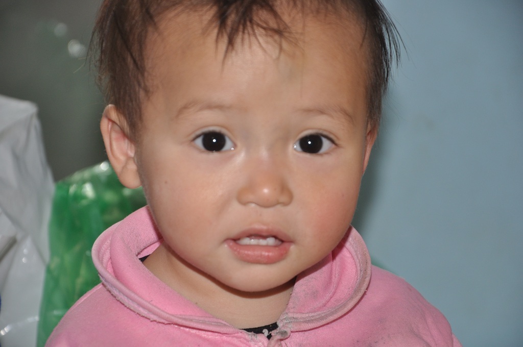 Ca phẫu thuật của em sẽ được diễn ra trong thời gian ngắn nữa.