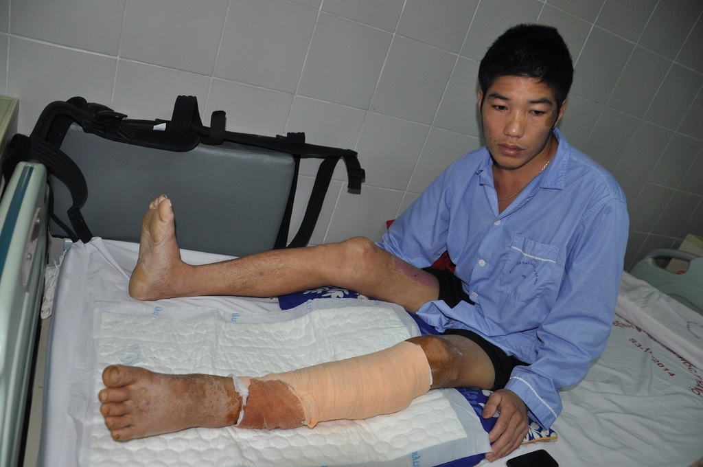 Sau ca phẫu thuật chân trái của Hừ đã được giữ lại, hiện em đang trong thời gian hồi phục và tập luyện.