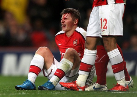 Các các thủ từng bị "máu tuôn xối xả" như C.Ronaldo - 6 Những dòng máu phun trào từ cơ thể các cầu thủ bóng đá