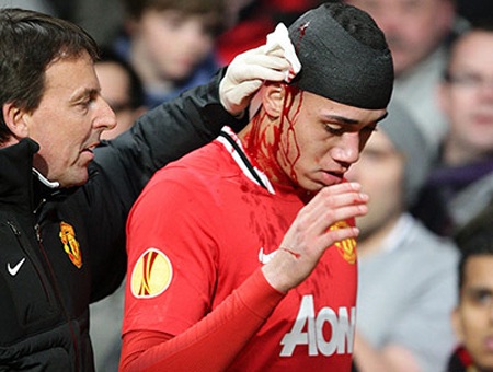 Các các thủ từng bị "máu tuôn xối xả" như C.Ronaldo - 2 Những dòng máu phun trào từ cơ thể các cầu thủ bóng đá