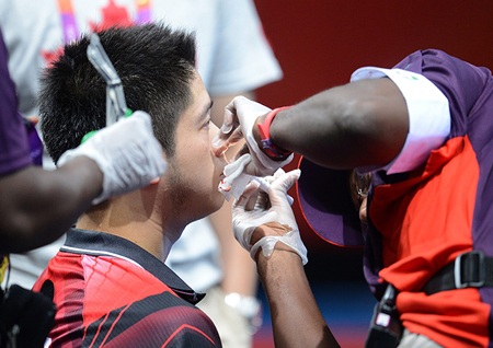 VĐV bóng bàn người Canada, Andre Ho đã bị chảy máu mũi sau dinh bóng đập vào mặt anh