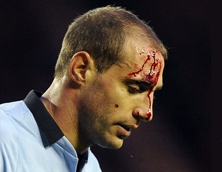 Man City thua Sunderland: Máu rơi, mồ hôi đổ và nước mắt lăn dài - 1 Gương mặt đổ máu của Zabaleta tại The Light